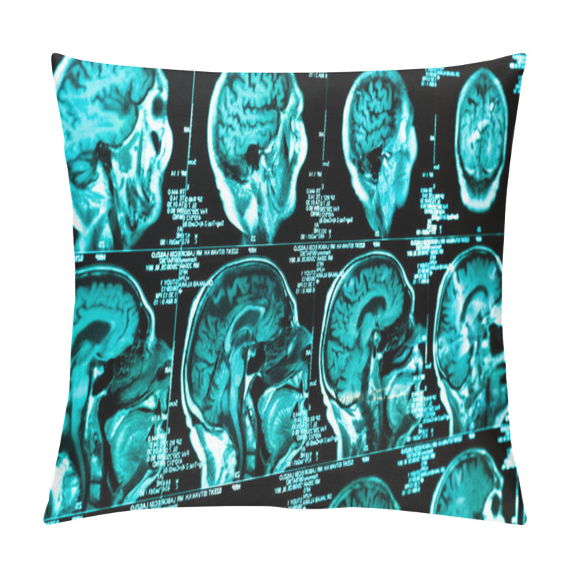 Personality  Ct Scan Of The Human Brain Tile Pillow Covers