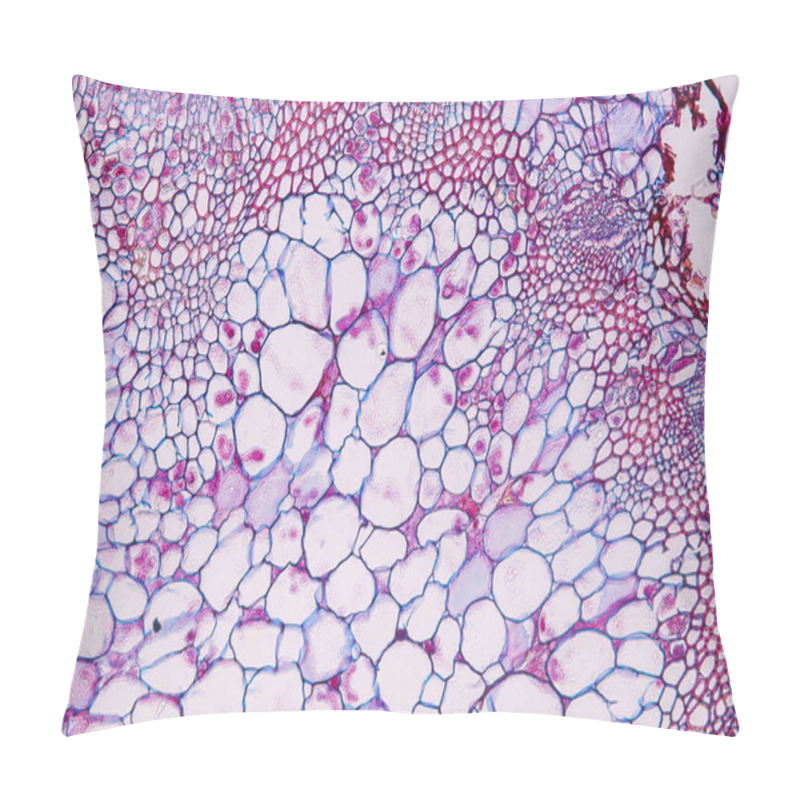 Personality  Zygomycota, Or Zygote Fungi ,Downy Mildew Of Cruzifers Host Tissue With Conidia Living In Decaying Plant On Slide Under The Microscope For Education. Pillow Covers