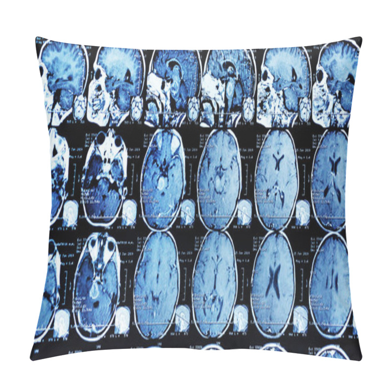 Personality  MRI Scan Of A Patient With A Tumor In The Brain Stem.  Pillow Covers