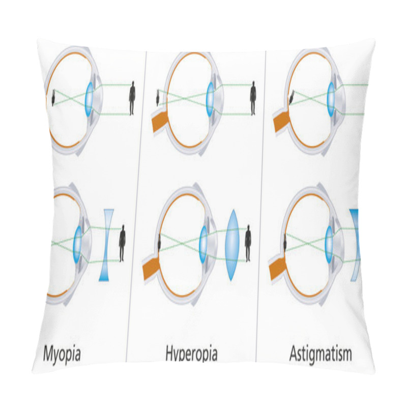 Personality  Vision Defects - Myopia, Hyperopia And Astigmatism Pillow Covers