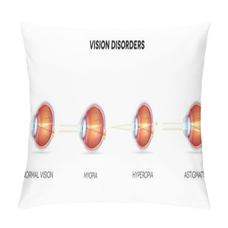 Personality  Eyesight Disorders Pillow Covers