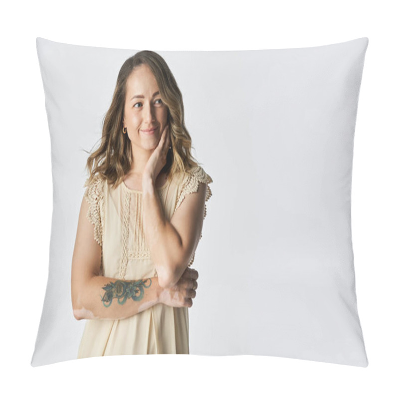 Personality  Young Woman With Vitiligo Smiles Gently, Resting Her Hand On Her Cheek, Showcasing Her Beauty. Pillow Covers