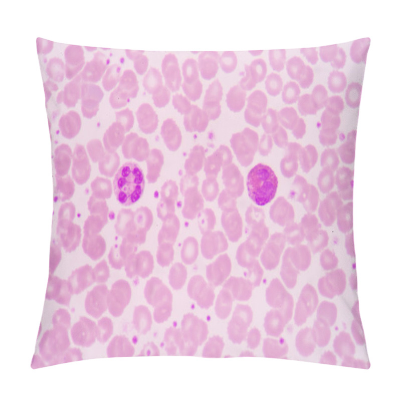 Personality  Blood Smear Is Often Used As A Follow-up Test To Abnormal Result Pillow Covers