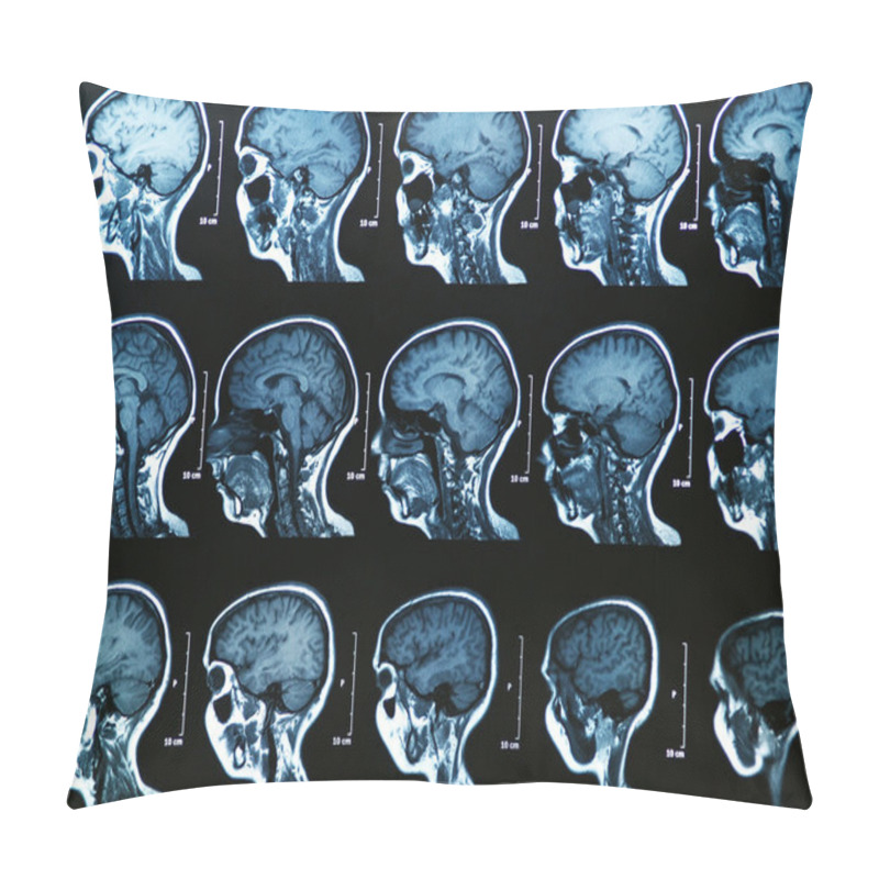 Personality  MRI Brain Scan Pillow Covers