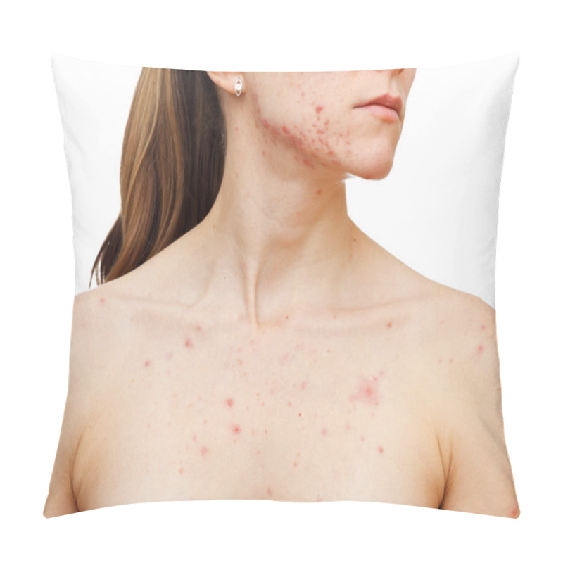 Personality  Skin Problems Pillow Covers