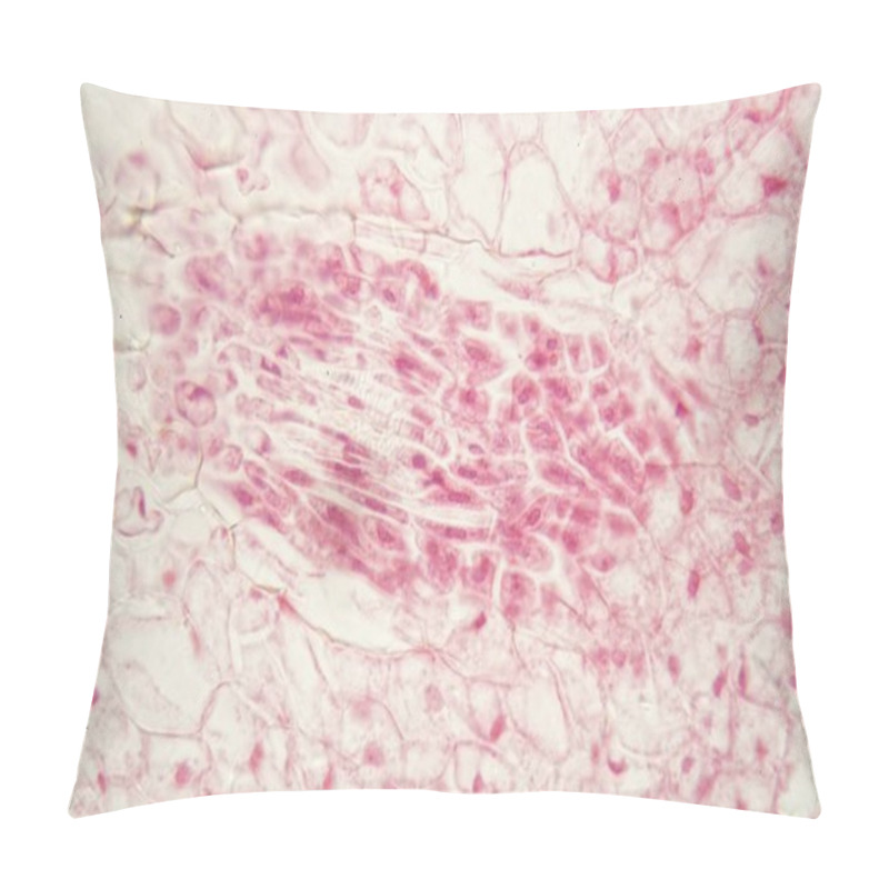 Personality  Root Bacteria Nodules Under The Microscope. Pillow Covers