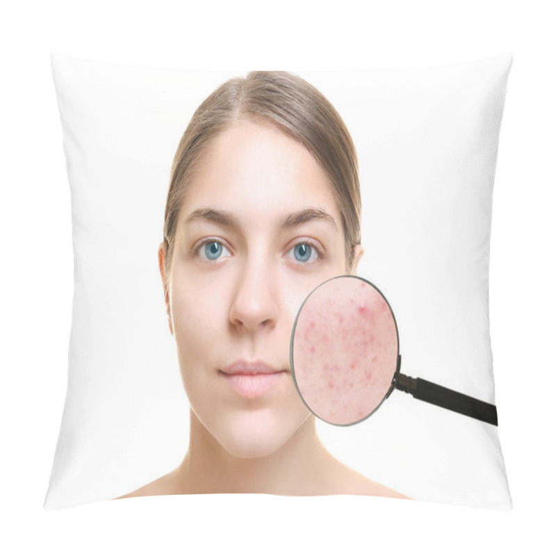 Personality  Acne And Skin Care Concept. Young Woman Before And After Cosmetic Procedure On White Background Pillow Covers