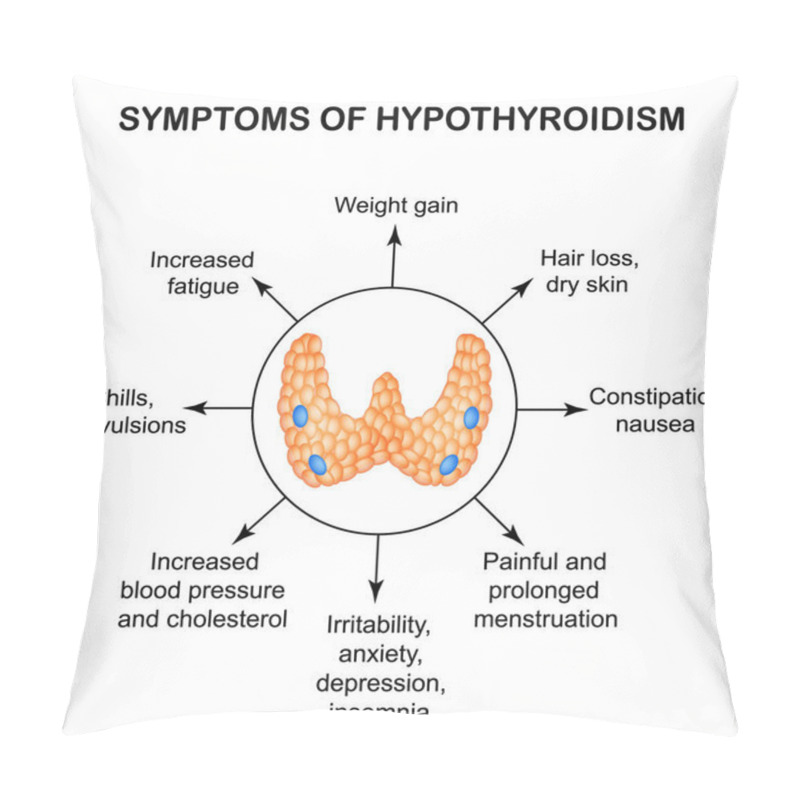 Personality  Symptoms Of Hypothyroidism. Thyroid. Infographics. Vector Illustration On Isolated Background. Pillow Covers