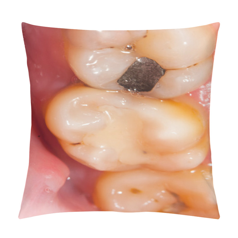 Personality  Dental Problems Pillow Covers