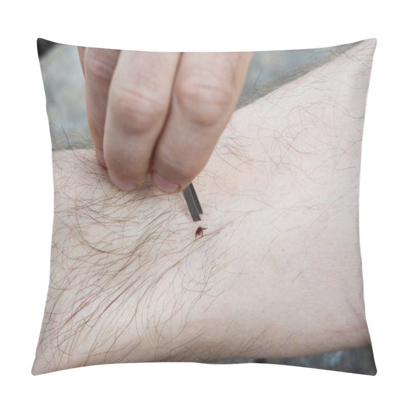 Personality  Removing A Blacklegged Tick Using Fine Pointed Tweezers. Matchless Way Of Tick Removal. Pillow Covers