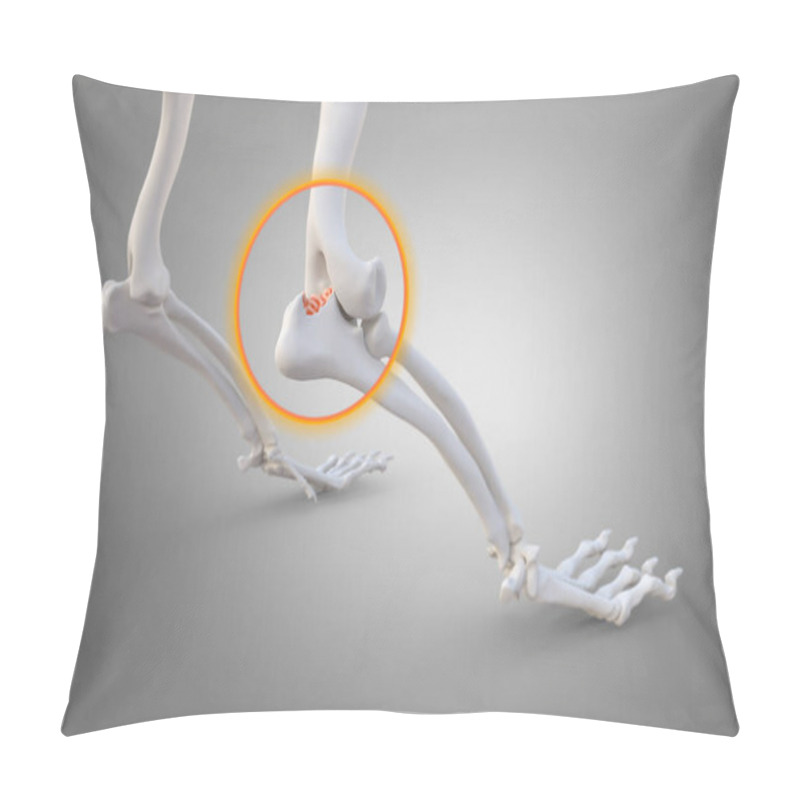 Personality  Canine Arthritis And Osteoarthritis Joint Inflammation, Deterioration Of Joint In Dogs, Elbow Joint And Legs, 3d Illustration Pillow Covers