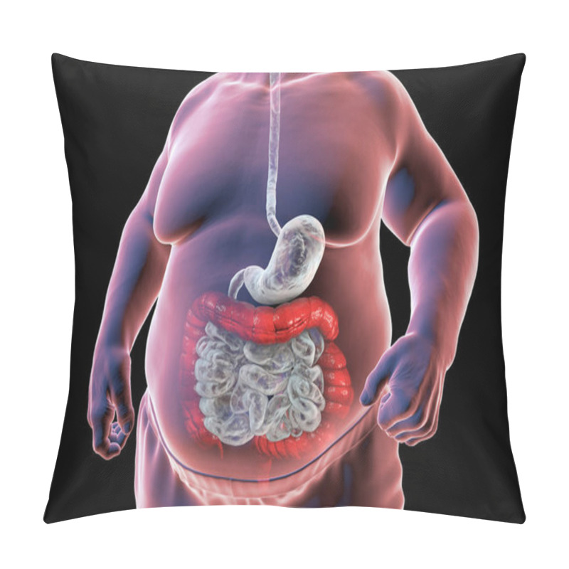 Personality  A 3D Medical Illustration Depicting The Upper Half Part Of A Senior Obese Male Body With A Highlighted Digestive System, Specifically Showcasing Large Bowel Spasms Observed In Irritable Bowel Syndrome Pillow Covers