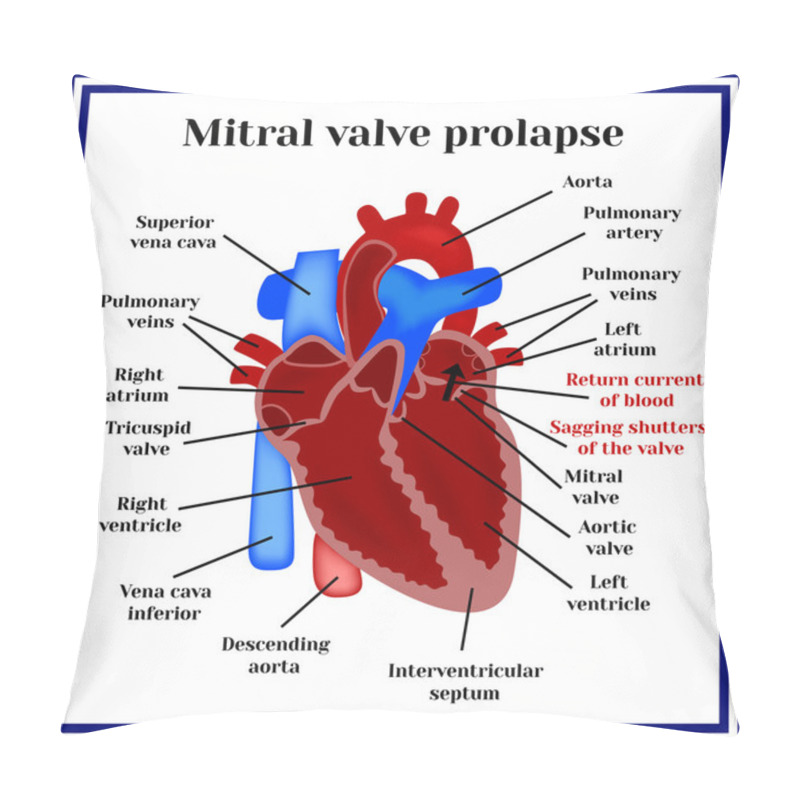 Personality  Heart Structure. Mitral Valve Prolapse. Cardiac Pathology. Pillow Covers