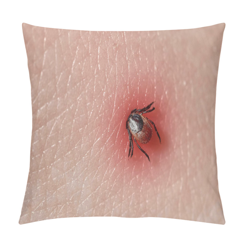 Personality  Sucking Tick Macro Photo On Human Skin. Ixodes Ricinus. Danger Of Infection. Biohazard Pillow Covers