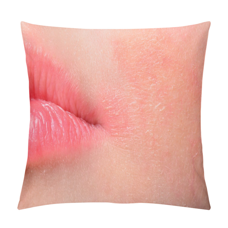 Personality  Atopic Dermatitis. Girl With Atopic Dermatitis Symptom On Skin Of Cheeks. Pillow Covers