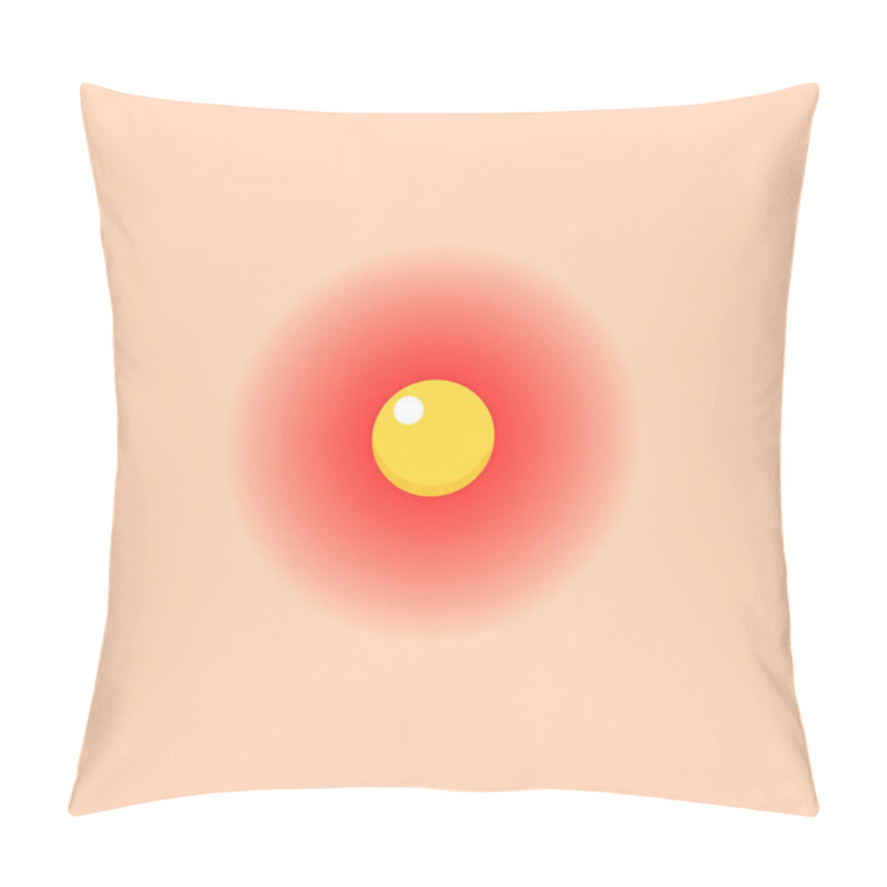 Personality  Vector Illstration Of Acne On Skin Icon. Flat Design. EPS10. Pillow Covers