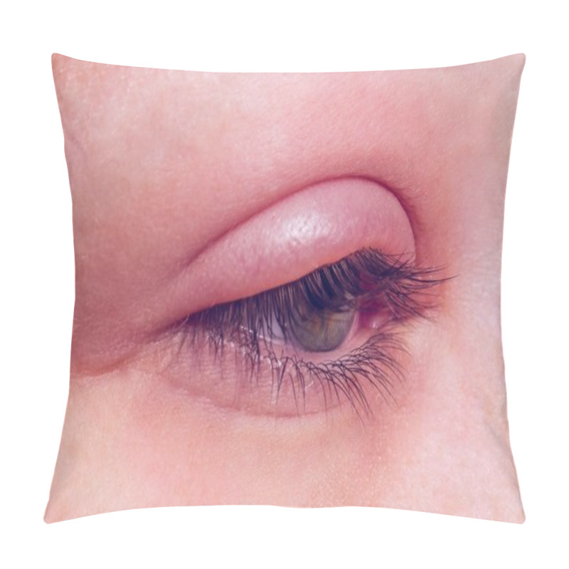 Personality  Barley Infection On The Eye Pillow Covers