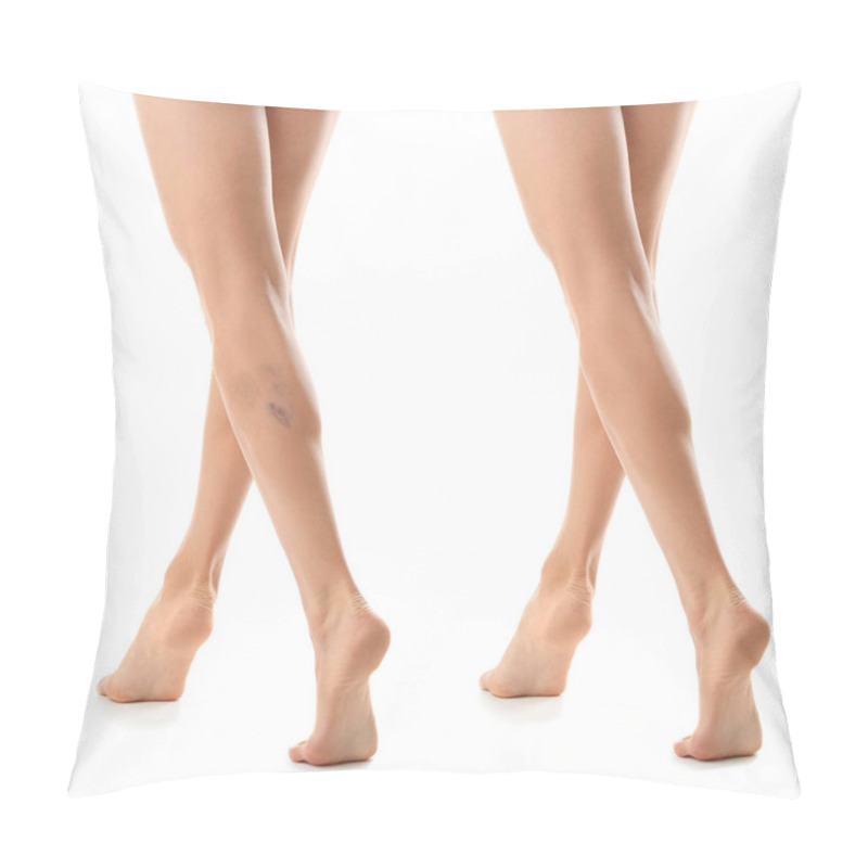 Personality  Young Woman Before And After Varicose Treatment Against White Background, Focus On Legs Pillow Covers