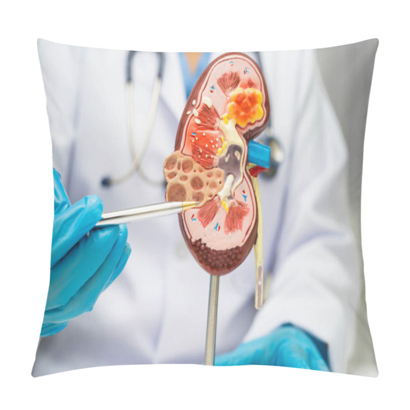 Personality  Chronic Kidney Disease, Doctor With Model For Treatment Urinary System, Urology, Estimated Glomerular Filtration Rate EGFR. Pillow Covers