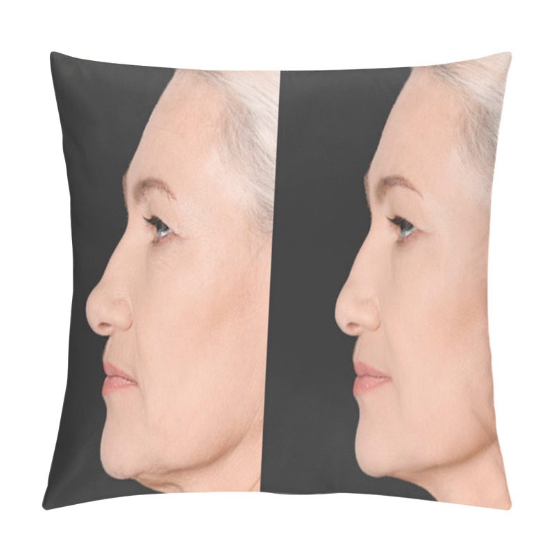 Personality  Mature Woman Before And After Cosmetic Procedure On Black Background  Pillow Covers