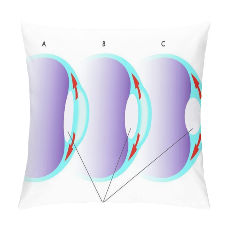 Personality  Medical Illustration Of The Visual Accomodation Pillow Covers