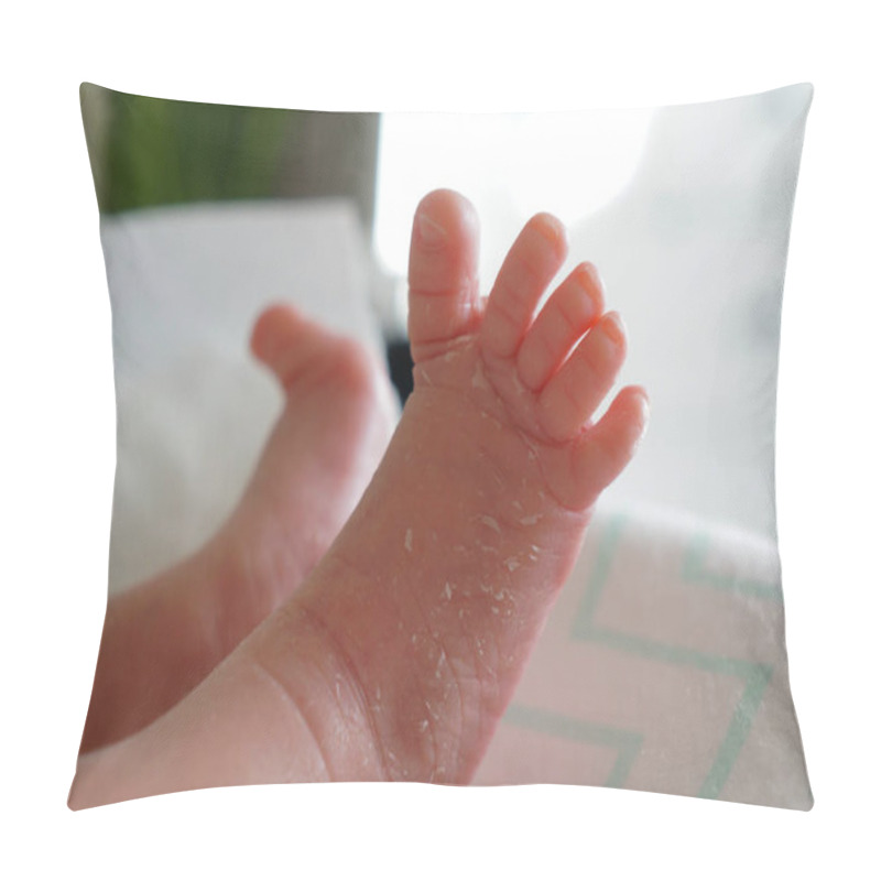 Personality   Pink Legs Of A Newborn Peeling Skin Pillow Covers