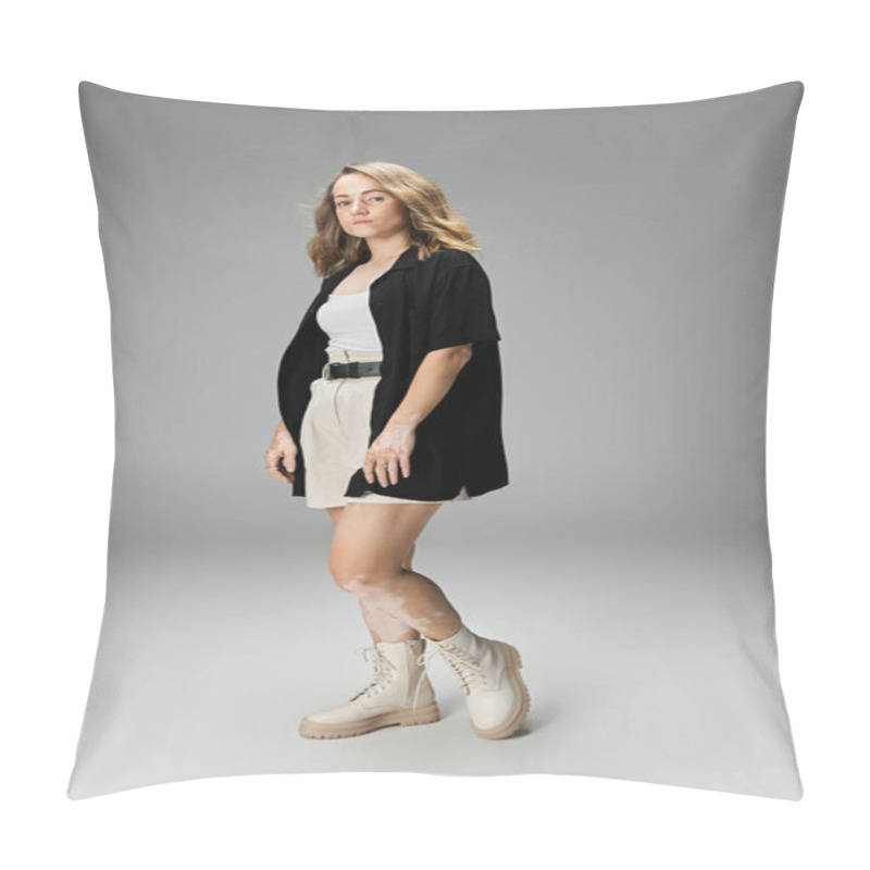 Personality  A Young Woman With Vitiligo Stands Confidently, Flaunting Her Beauty In A Casual Outfit. Pillow Covers