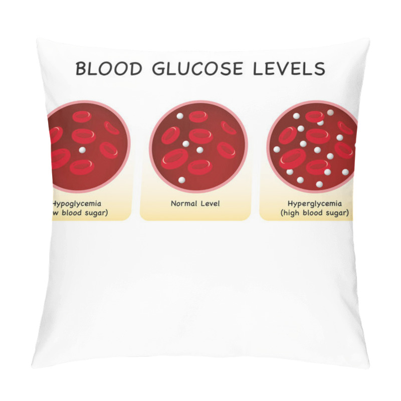 Personality  Glucose In The Blood Vessel. Normal Level, Hyperglycemia (high Blood Sugar), Hypoglycemia (low Blood Sugar). Vector Illustration Pillow Covers