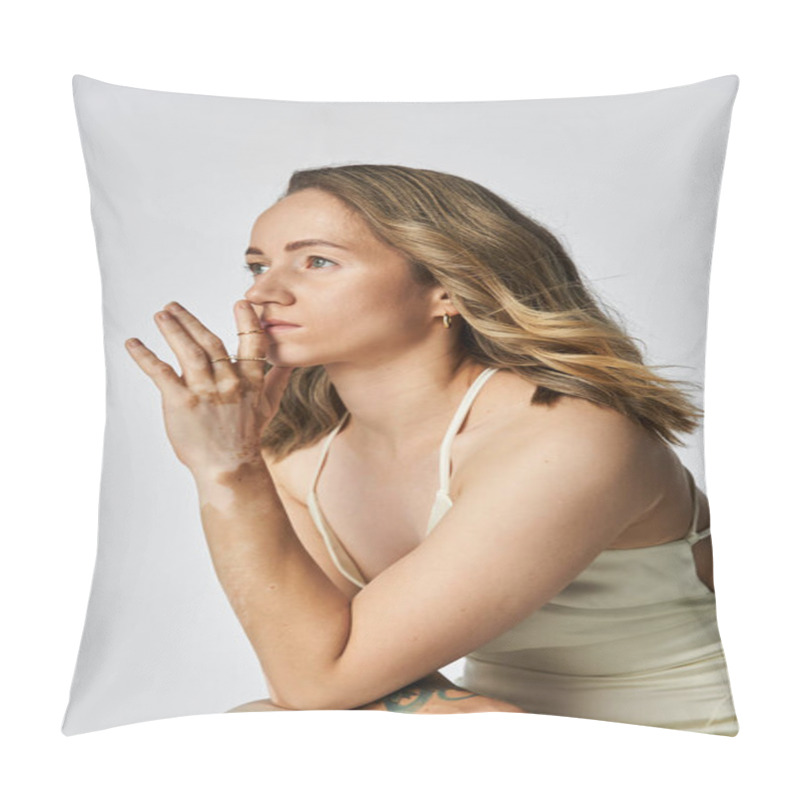 Personality  A Young Woman With Vitiligo Radiates Beauty, Highlighting Her Unique Features And Style. Pillow Covers