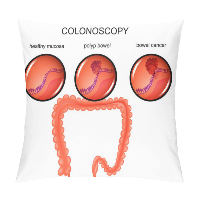 Personality  Polyp Of The Large Intestine And Cancer Pillow Covers