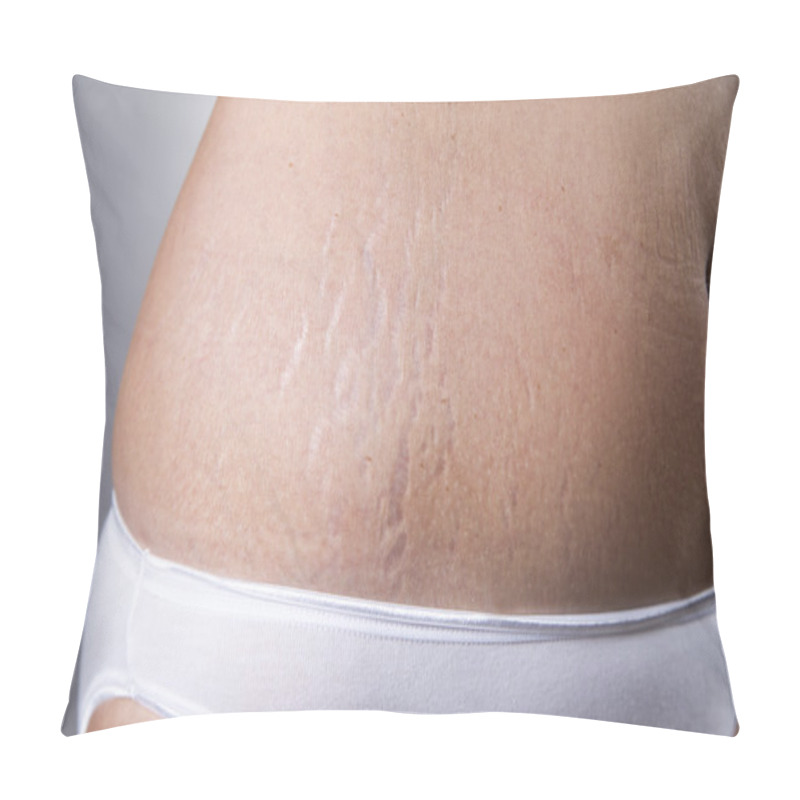 Personality  Female Belly With Stretch Marks Closeup Pillow Covers