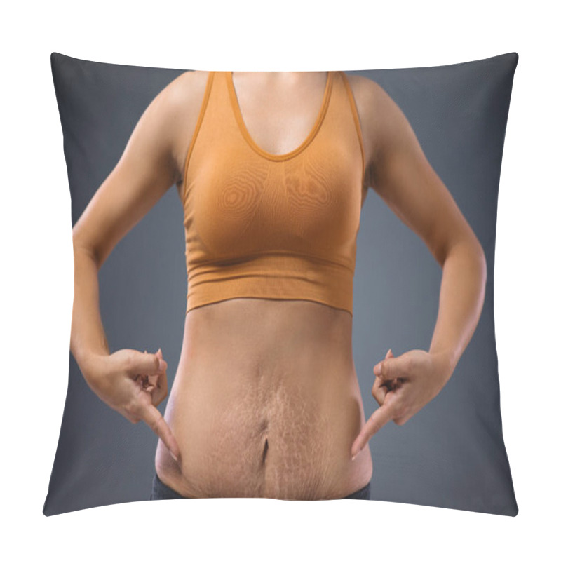 Personality  Young Mum Standing And Pointing At Her Belly Full Of Stretch Marks After Pregnancy. Pillow Covers