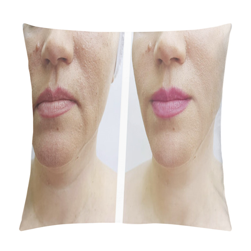 Personality   Woman Face Wrinkles Before And After Correction Pillow Covers