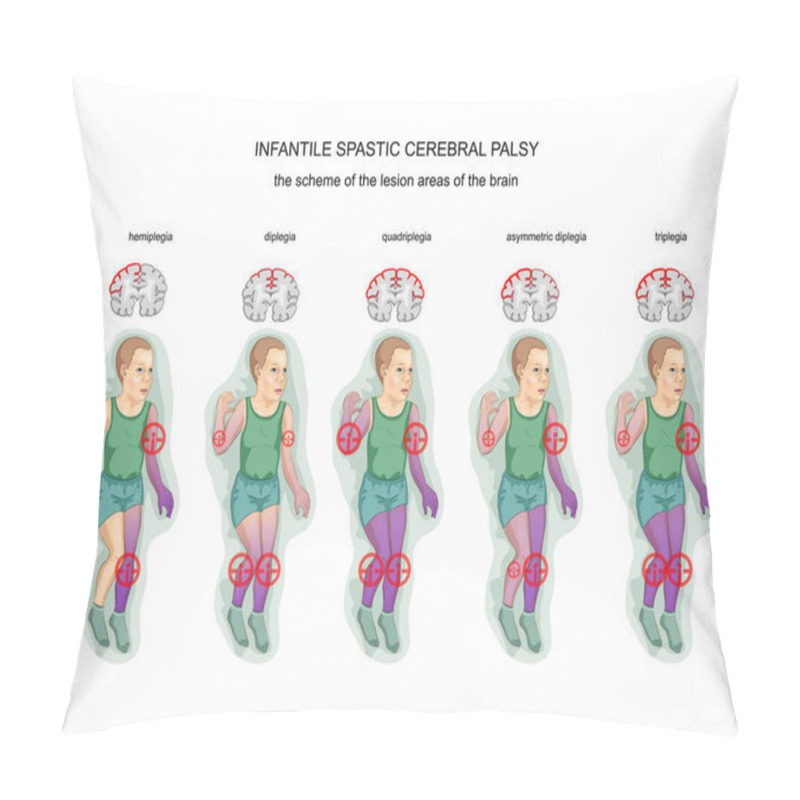 Personality  Spastic Infantile Cerebral Palsy Pillow Covers