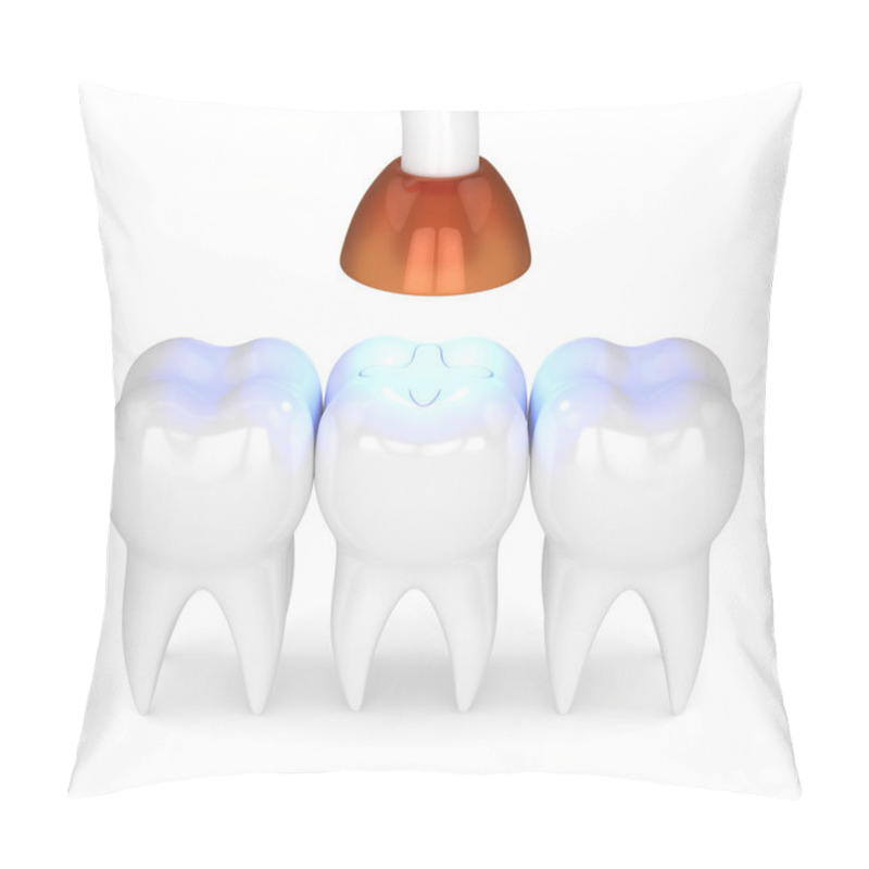 Personality  3d Render Of Teeth With Dental Polymerization Lamp And Light Cured Inlay Filling Over White Background Pillow Covers