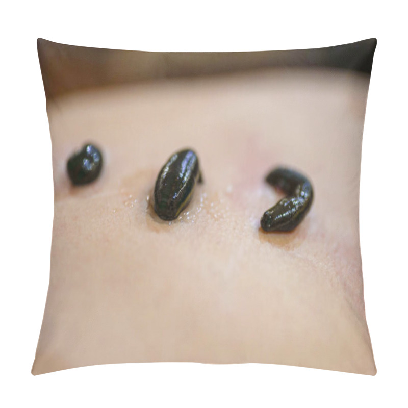 Personality  Leeches On His Stomach In The Liver Area And The Navel. Pillow Covers