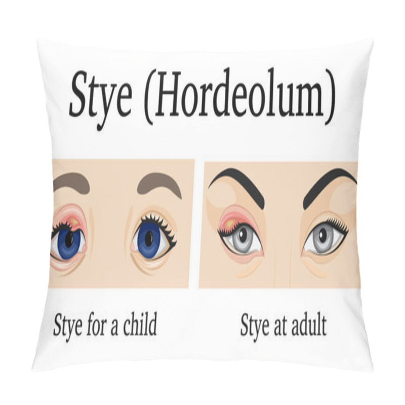 Personality  Illustration Of Stye Pillow Covers