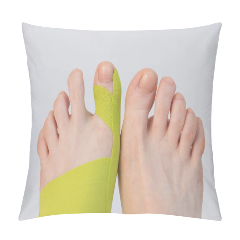 Personality  Correction Of The Big Toe. Haliux Valgus. Taping With Flat Feet. Taping When Fingers Are Deformed. Innovative Medicine. Pillow Covers