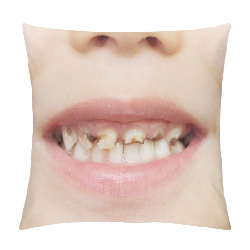 Personality  Bad Teeth Pillow Covers