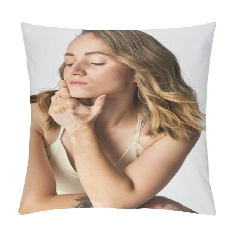 Personality  A Young Woman With Vitiligo Poses Confidently, Radiating Beauty And Self Assurance. Pillow Covers