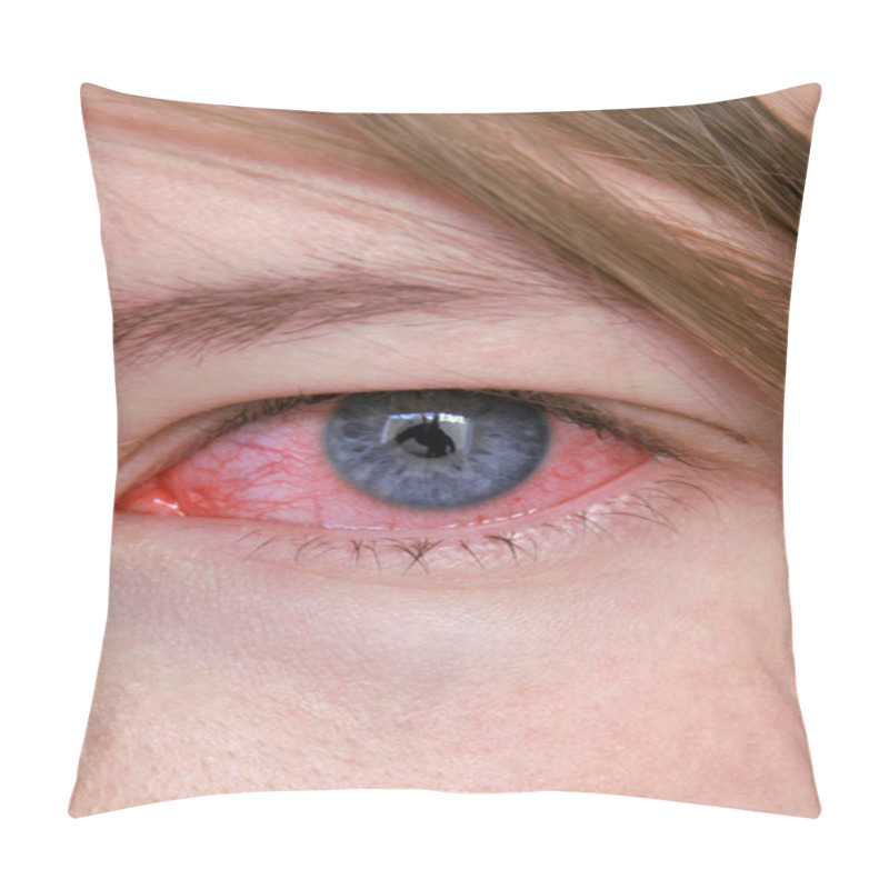 Personality  Infected Eye. Pillow Covers