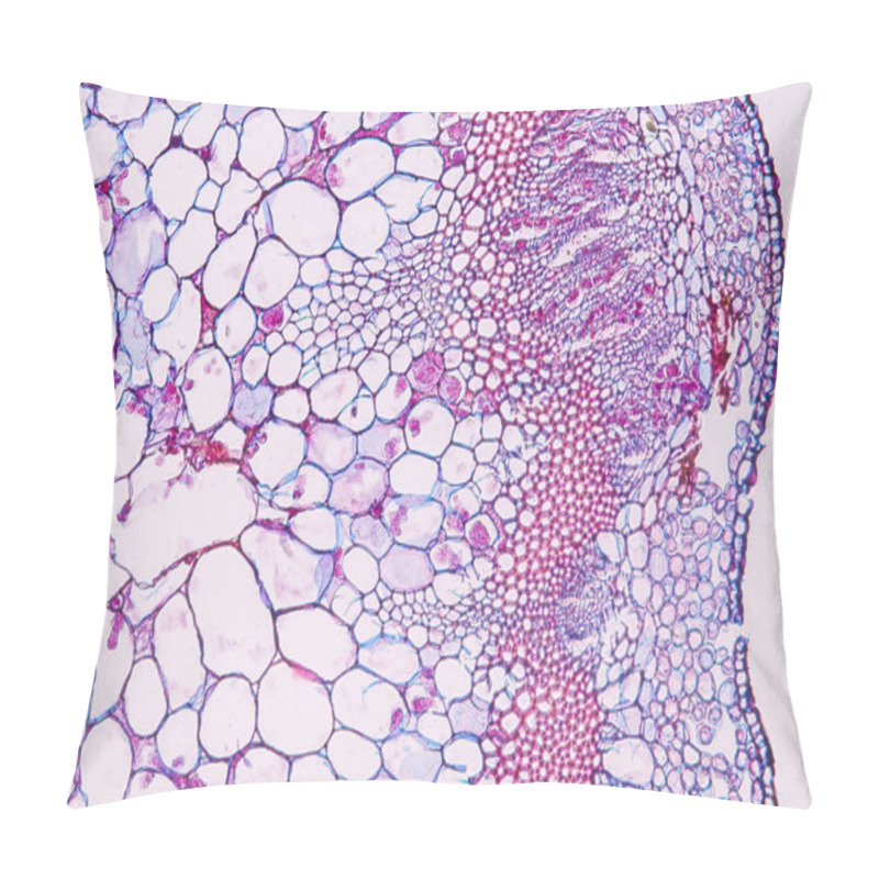 Personality  Zygomycota, Or Zygote Fungi ,Downy Mildew Of Cruzifers Host Tissue With Conidia Living In Decaying Plant On Slide Under The Microscope For Education. Pillow Covers