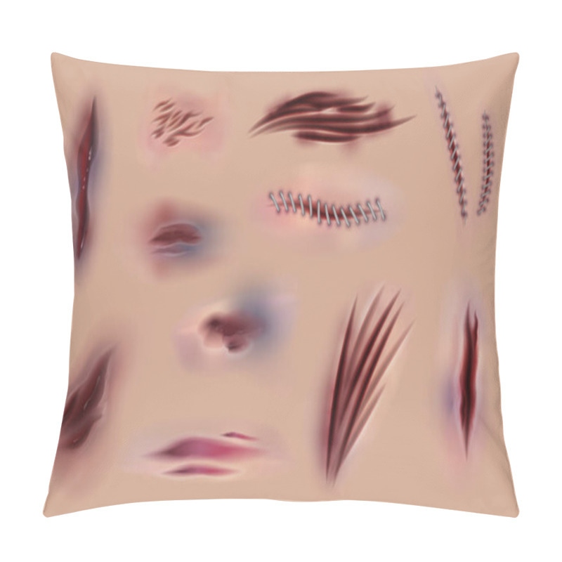 Personality  Skin Scars And Wounds. Surgery Stitches And Horror Wounds On Skin, Different Injuries And Bruises. Vector Body Wound And Scratches Pillow Covers