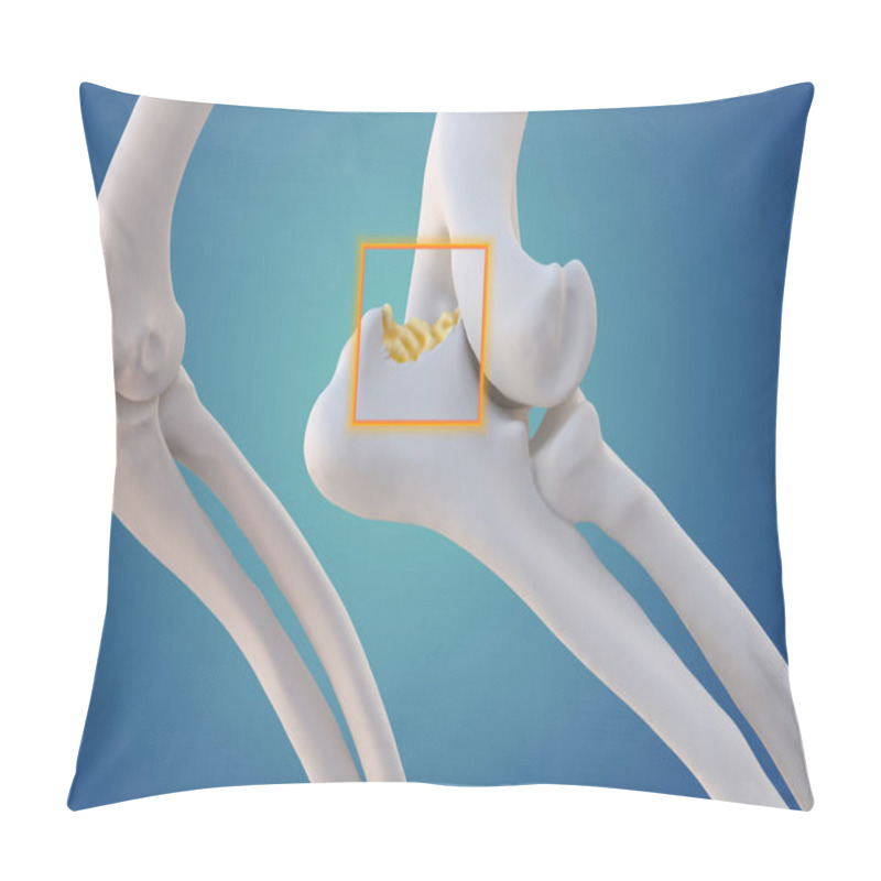 Personality  Canine Arthritis And Osteoarthritis Joint Inflammation, Deterioration Of Joint In Dogs, Elbow Joint, 3d Illustration Pillow Covers