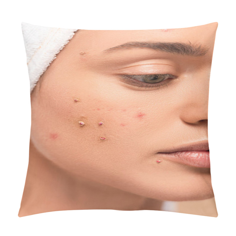 Personality  Close Up Of Girl With Acne On Face Isolated On Beige  Pillow Covers