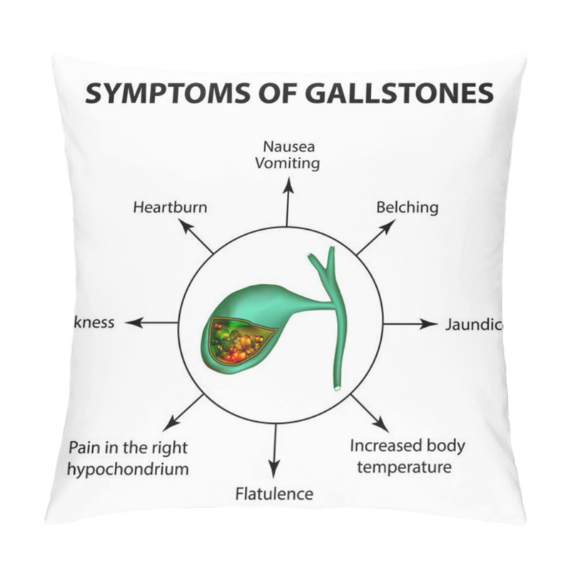 Personality  Symptoms Of Stones In The Gallbladder. Infographics. Vector Illustration On Isolated Background Pillow Covers