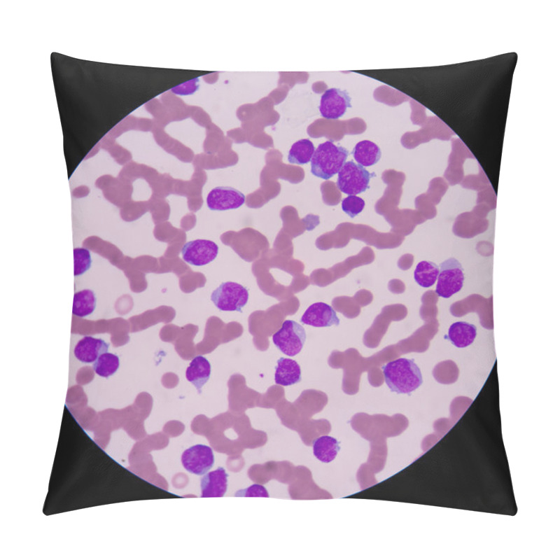 Personality   Smaller Red To Pink Normal Red Blood Cells Or Erythrocytes. Pillow Covers