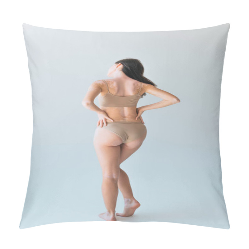 Personality  Back View Of Young Woman With Vitiligo Standing With Hands On Hips On Grey Pillow Covers