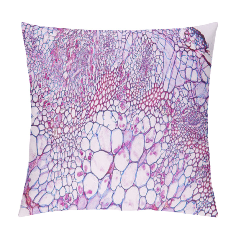 Personality  Zygomycota, Or Zygote Fungi ,Downy Mildew Of Cruzifers Host Tissue With Conidia Living In Decaying Plant On Slide Under The Microscope For Education. Pillow Covers