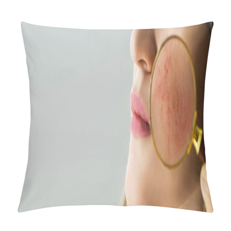 Personality  Rosacea Face Skin Problem And Aesthetic Treatment Pillow Covers